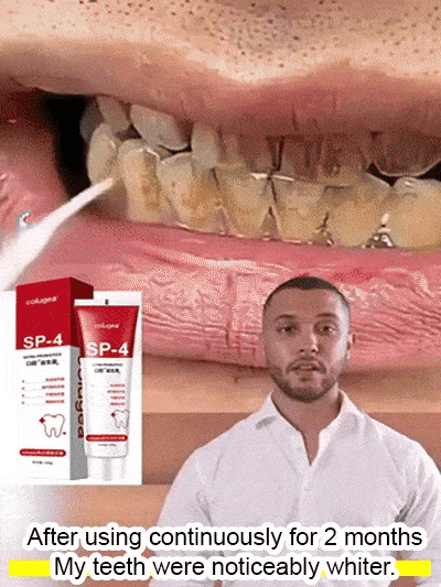 Intense teeth whitening toothpaste
